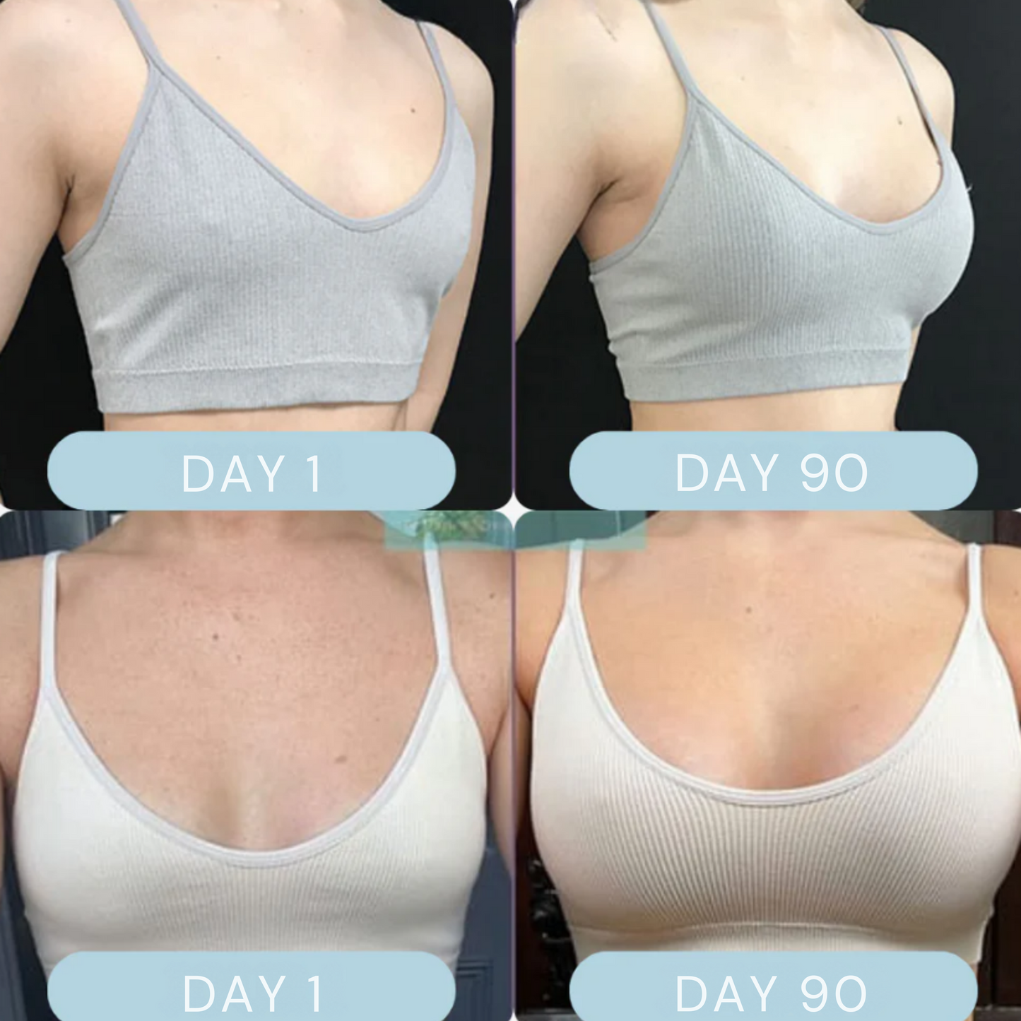 SO.SCULPT - Breast Enhancing Patch