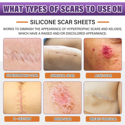 Silicone scar sheets