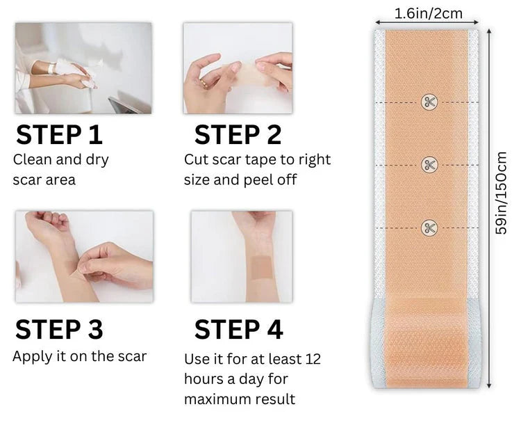 Silicone scar sheets